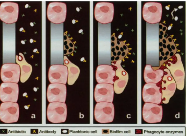 Figure  4 :  Présentation  schématique  de  la  réponse  immunitaire  lors  d’une  infection  liée  au  biofilm