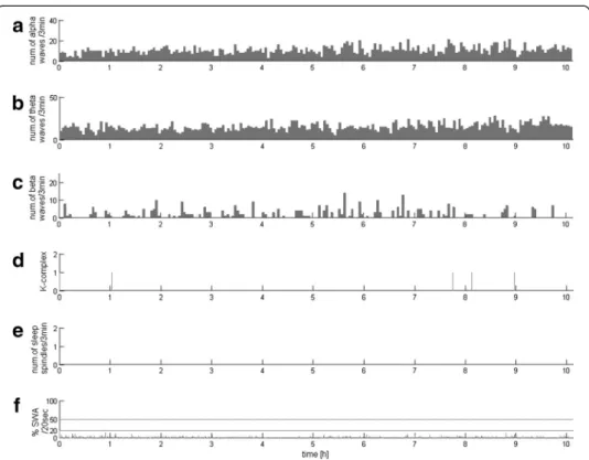 Figure 3 EEG profile for all-night VS/UWS recording with the lack of sleep spindles and poor SWA, but the presence of alpha, theta, beta waves- in a large proportion but continuous and not differentiated activity