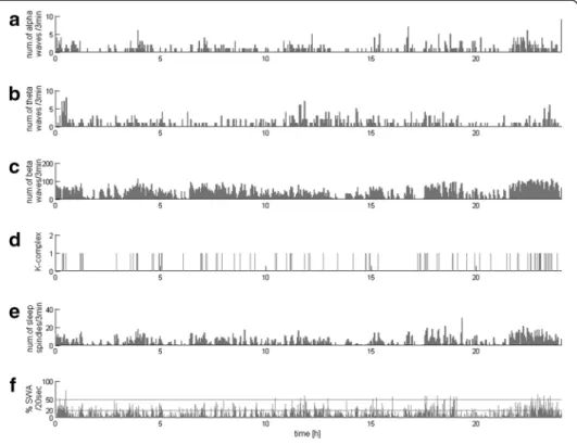 Figure 7 presents statistically significant relations between etiology and EEG-derived parameters: