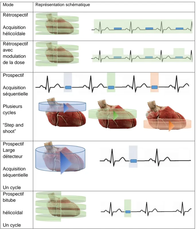 Figure 4. Synthèse des techniques d’acquisition et de synchronisation à l’ECG  lors d’un coroscanner 