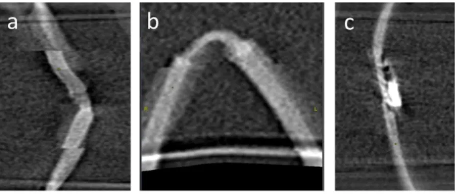 Figure 14. Artefacts relevés lors de l’analyse 