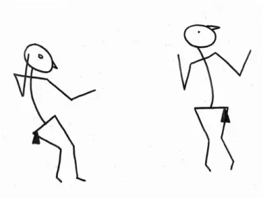 FIGURE 2: A gauche : ATNP. A droite : Posture en hyper-extension. 