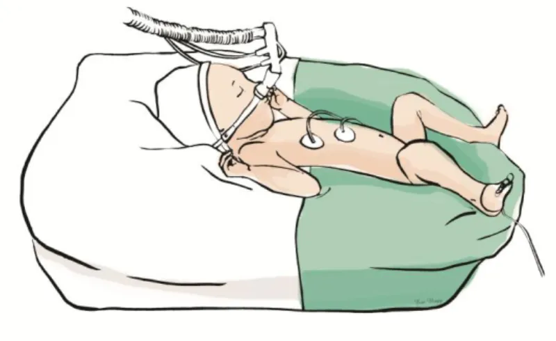 FIGURE 6: Installation d'Emanuel avant le soin