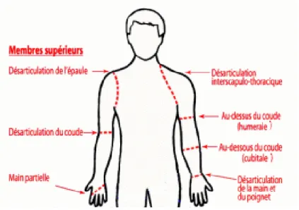 Figure 2 : Les niveaux d’amputation du membre supérieur  1.1.4 Les suites postopératoires 