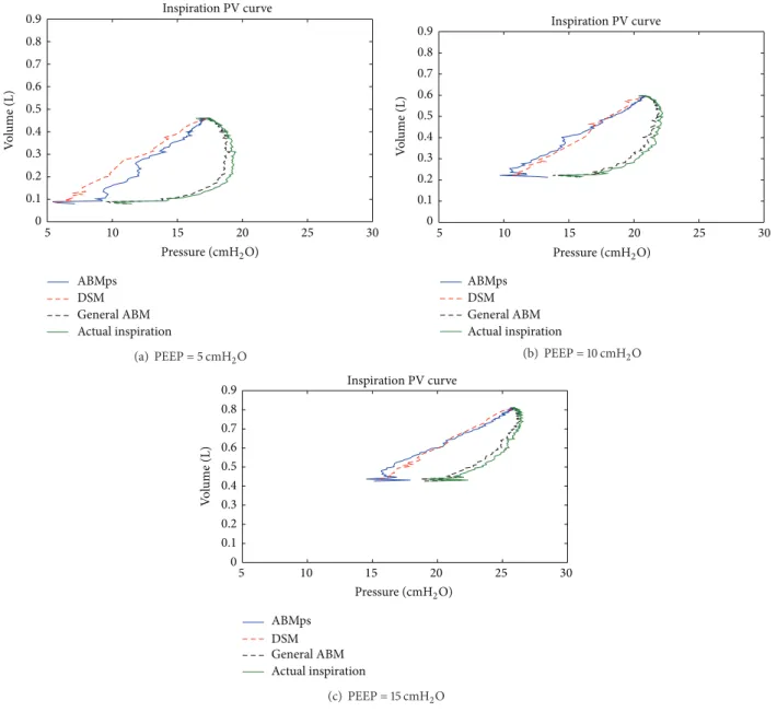 Figure 7: Comparison of pressure volume curve for patient S1 with COPD for general ABM, ABMps, DSA, and actual inspiration with 