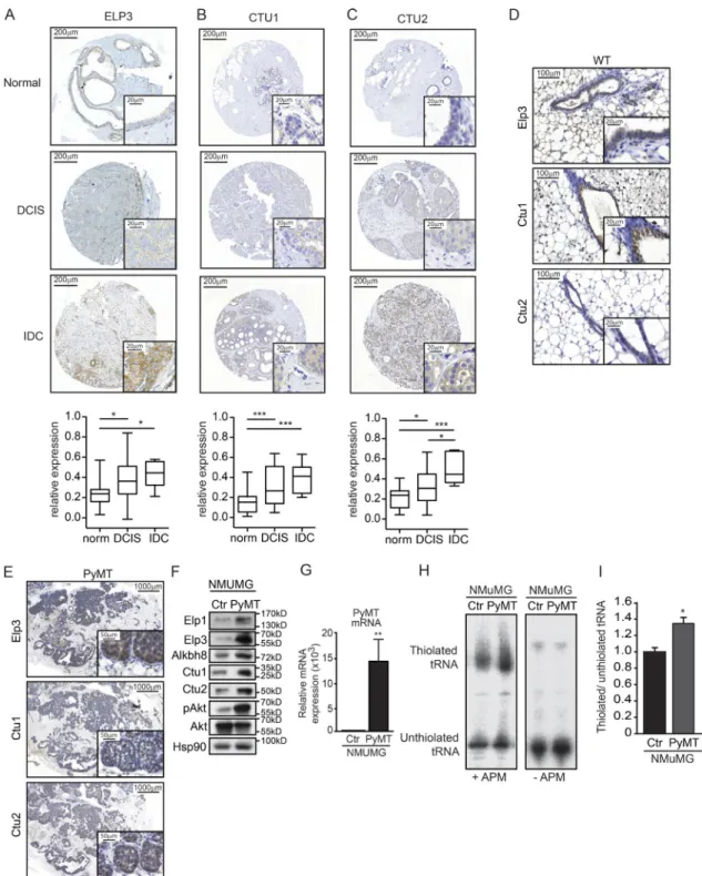 Figure 1.  U34 tRNA-modifying enzymes are up-regulated in human breast cancer. (A–C) Tissue microarray analysis of ELP3 (A), CTU2 (B), and CTU1 (C)  protein expression in normal breast tissue (n = 23) and in samples of noninvasive or invasive human breast 