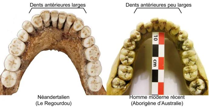 Figure 1. Comparaison des dents permanentes inférieures entre un Néandertalien et un Homme moderne 