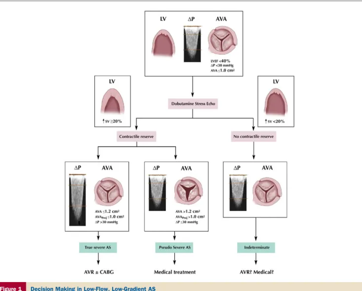 Figure 1 Decision Making in Low-Flow, Low-Gradient AS