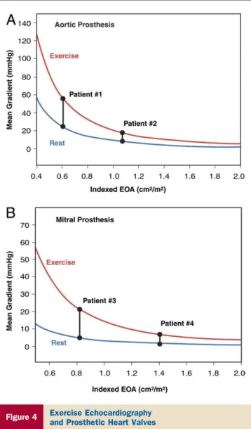 Figure 4 Exercise Echocardiography and Prosthetic Heart Valves