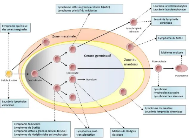 Figure 1 Classification des syndromes lymphoprolifératifs selon leur cellule d’origine 