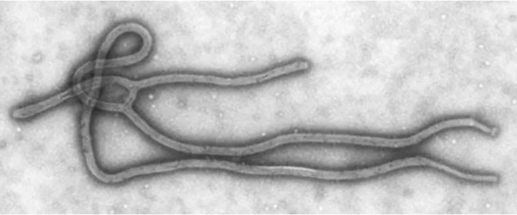 Figure  4.  Le  virus  Ebola  Zaïre  visible  au  microscope  électronique  à  balayage