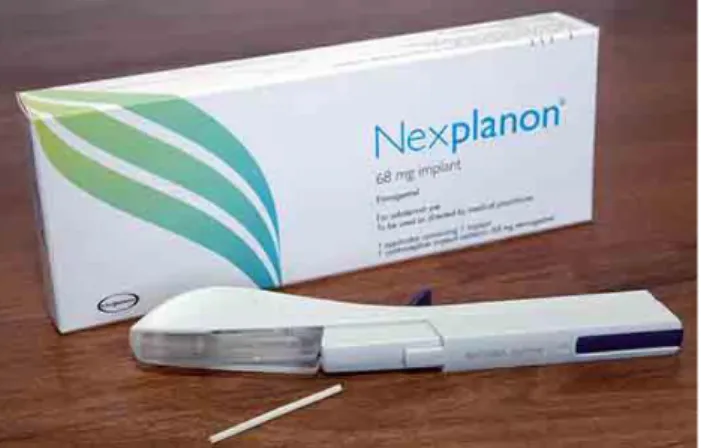 Figure 12 : Implant contraceptif Nexplanon®  20