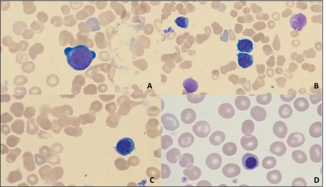 FIGURE 3 PRÉCURSEURS ÉRYTHROCYTAIRES OBSERVABLES AU MICROSCOPE, MGG X50   A-PROÉRYTHROBLASTE B-ÉRYTHROBLASTE BASOPHILE C-ÉRYTHROBLASTE 