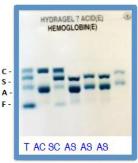 FIGURE 11 GEL D’ELECTROPHORESE EN MILIEU ACIDE