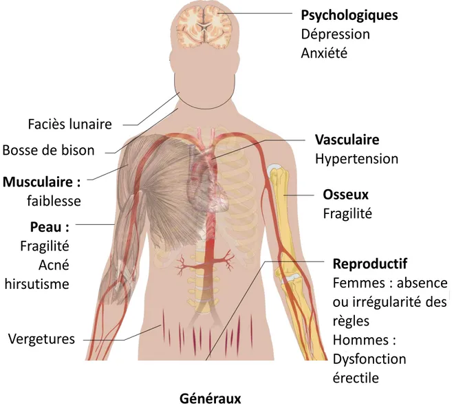 Figure 3 : Symptômes observés dans le syndrome de Cushing. 