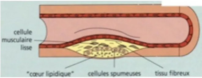 Figure 14: La plaque compliquée 2 