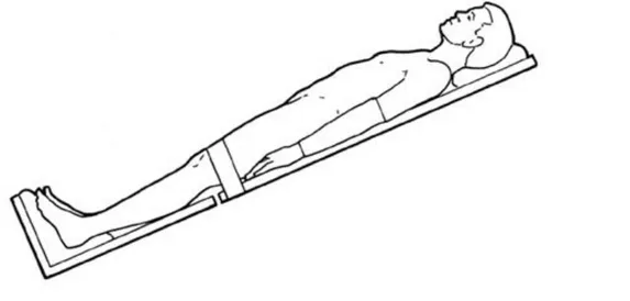 Figure 15 : Patient en position Trendelenburg inversée 