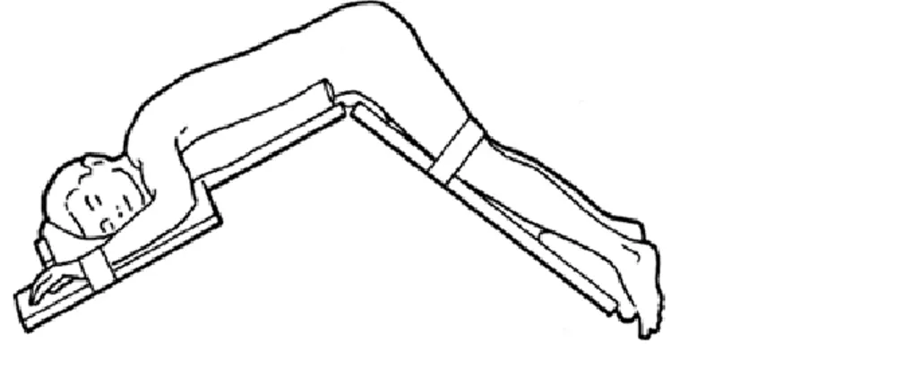 Figure 18 : Patient en position Jackknife 