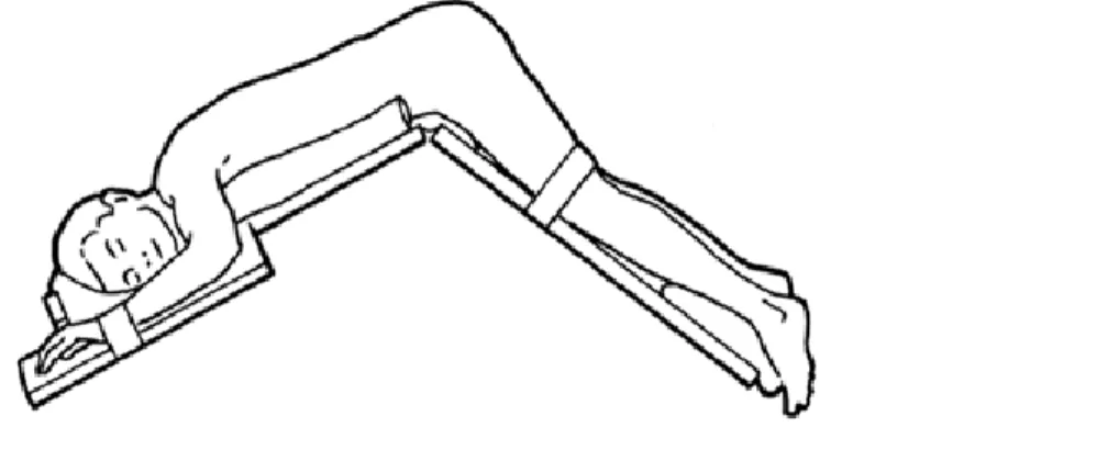 Figure 18 : Patient en position Jackknife 