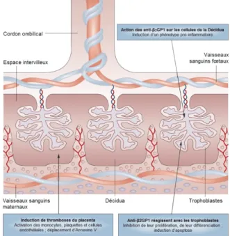 Figure 8 Implication des aPL dans les complications obstétricales