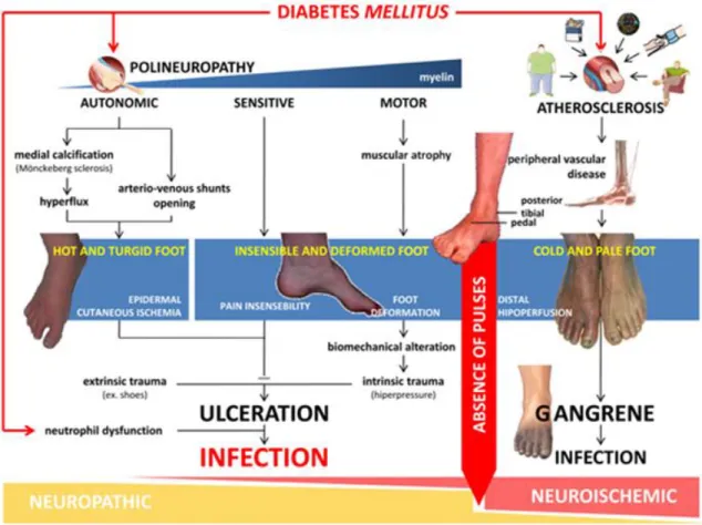 Figure 1. Différentes causes d’ulcération du pied diabétique (22) 