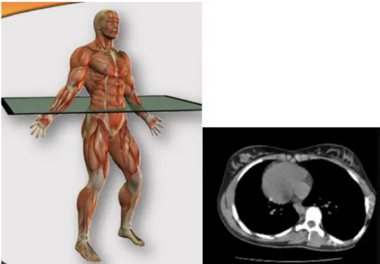 Figure 3 : Plan sagittal - Modification des courbures physiologiques (cyphose et lordose) (9) 