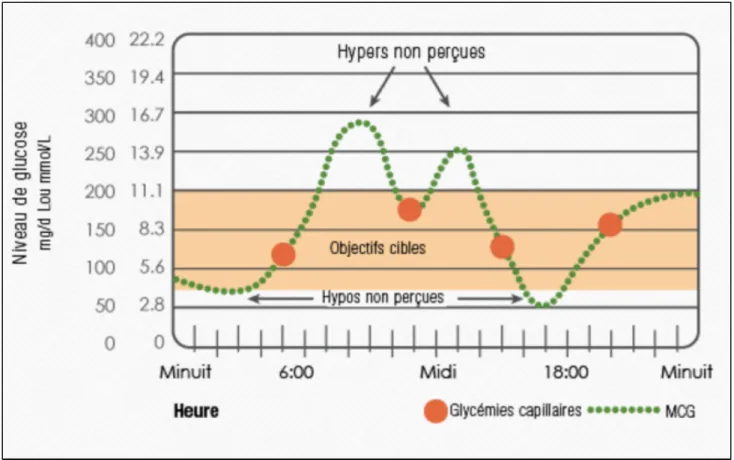 Figure 10 : graphique de tendances glycémiques obtenu avec un CGMS (31) 