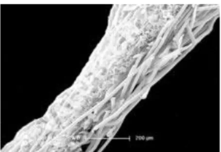 Figure 3 : Les fibres du non tissé en cellulose  en microscopie d’après Arjowiggings  