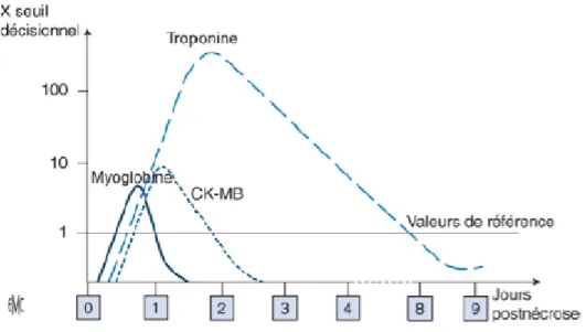 Figure 10 : Cinétiques des marqueurs de nécrose myocardique observées en cas d’infarctus du myocarde (18) 