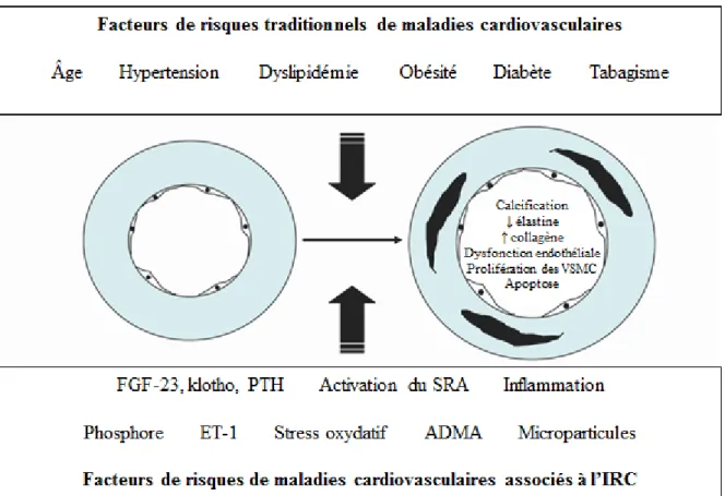 Figure 1.9 : Facteurs de risque de la calcification et du remodelage vasculaire en IRC 