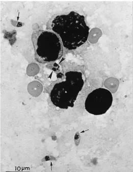 Figure 2: Tachyzoïtes de Toxoplasma gondii(8)  Tachyzoïtes se divisant : grosse flèche 