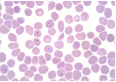 Figure 1 : Frottis de sang : trophozoïtes de  Plasmodium falciparum - Association Française des  Enseignants de Parasitologie et Mycologie (ANOFEL) 