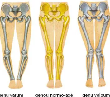 Figure 2 : Les différents axes de genoux. 