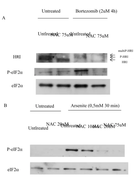 Figure 5 –  Test d’inhibition des DRO.  (A) Test d’inhibition des ROS en condition de stress par inhibition du  protéasome  grâce  au  Bortezomib