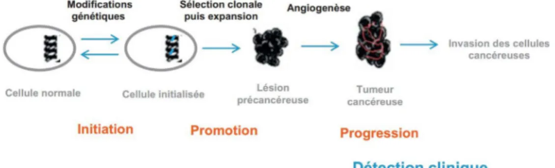 Figure 4 : Les différentes étapes de la cancérogenèse (Mongaret et Sautou 2016)