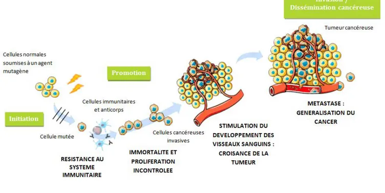 Figure 1 : Etape de la cancérogenèse 1