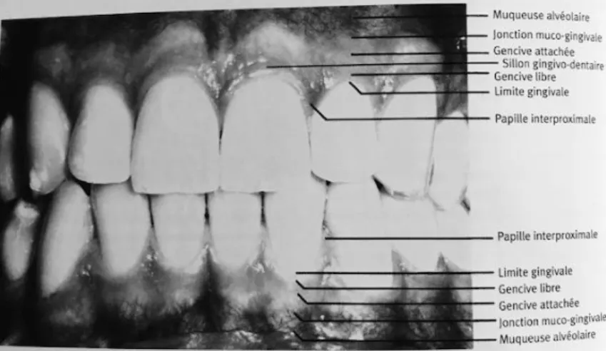 Figure 3 : schéma des différentes gencives de la bouche (2). 