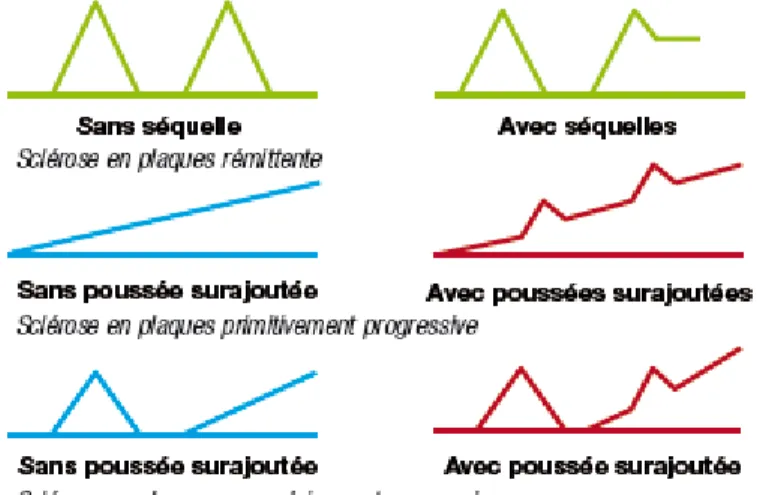 Figure 2 – Les différents modes évolutifs de la sclérose en plaques (5) 