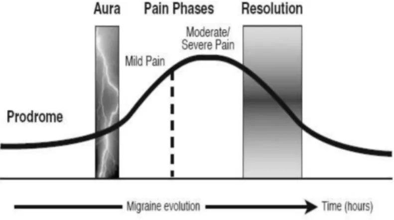 Figure  2 :  Modèle  de  Convergence  :  Description  de  la  migraine  comme  un  évènement  clinique avec un début, un milieu et une fin 