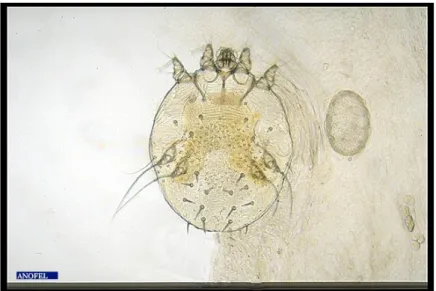 Figure 5 : Sarcopte femelle adulte et œuf observés au microscope optique lors  d’une analyse de squame (13) 