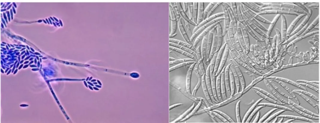 Figure 17 : Observation microscopique de l’appareil végétatif de Fusarium verticillioides et de  macroconidies de Fusarium graminearum (6) 