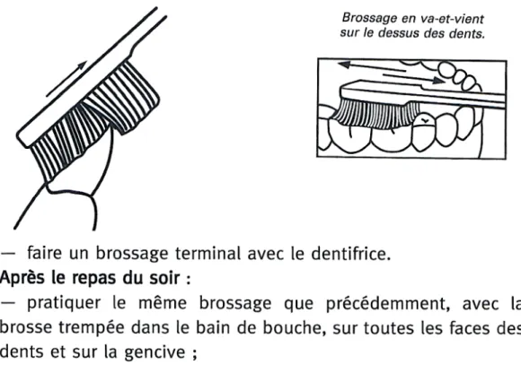 Figure 12 : Fiche technique de brossage avec schémas explicatifs  (22)