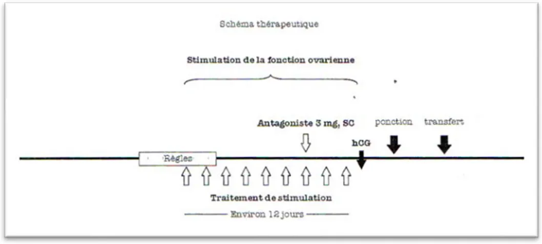 Figure 11 : protocole antagoniste (dose unique) (20) 