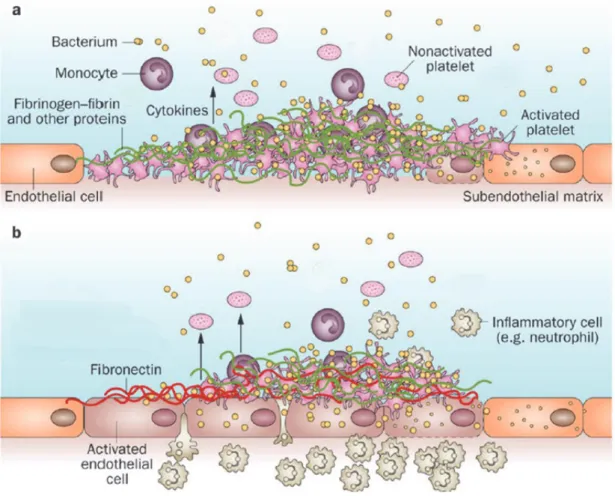 Figure 7. Mécanisme de formation de l’endocardite infectieuse.  