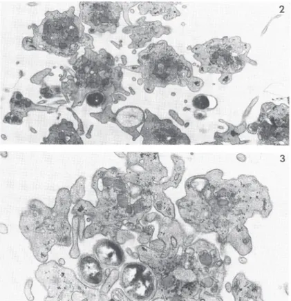 Figure 8. Agrégation plaquettaire en présence de Staphylococcus aureus (souche 502A). 