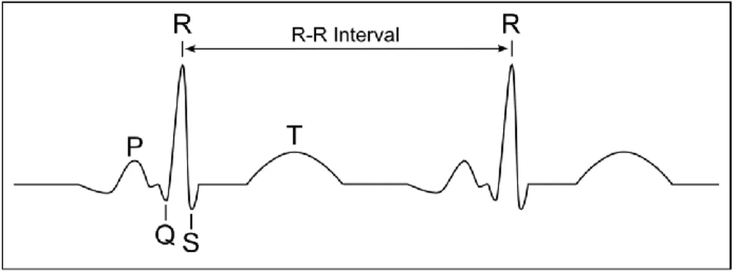 Figure 1.3 L’intervalle RR 