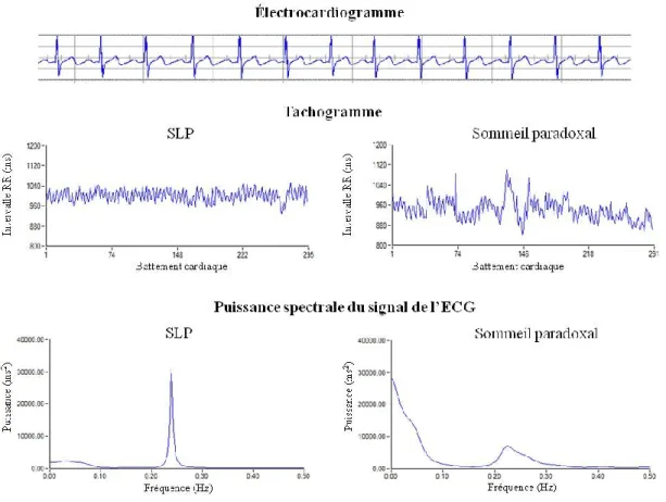 Figure 1.4 Analyse spectrale de l’ECG en SLP et en sommeil paradoxal 