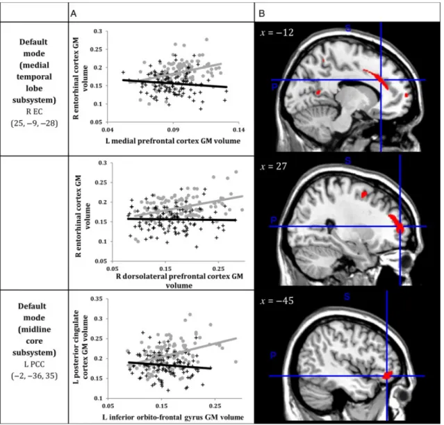 Figure 3. A)   Correlations   between   GM   volumes   extracted   from   a   4-mm   radius   sphere centered   on   the   ROI   and   a   4-mm   radius   sphere   centered   on   the   peak   voxel   expressing decreased structural association in AD compa