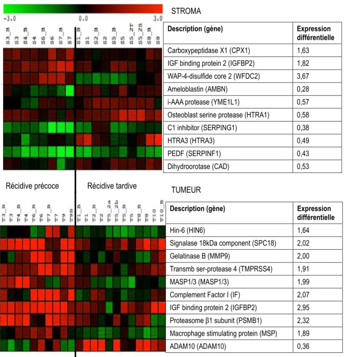 Figure  4–2. Gènes avec  différence d’expression selon la durée de survie sans récidive dans des  tumeurs séreuses de grade élevé, selon les analyses SAM 