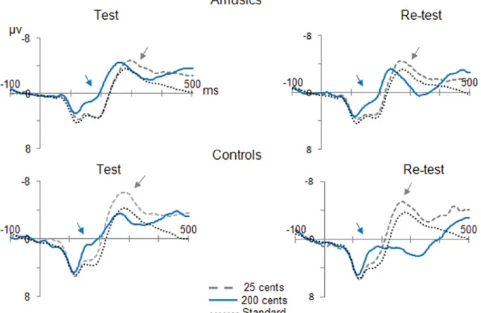 Figure 3.  Preattentive brain responses to pitch changes 